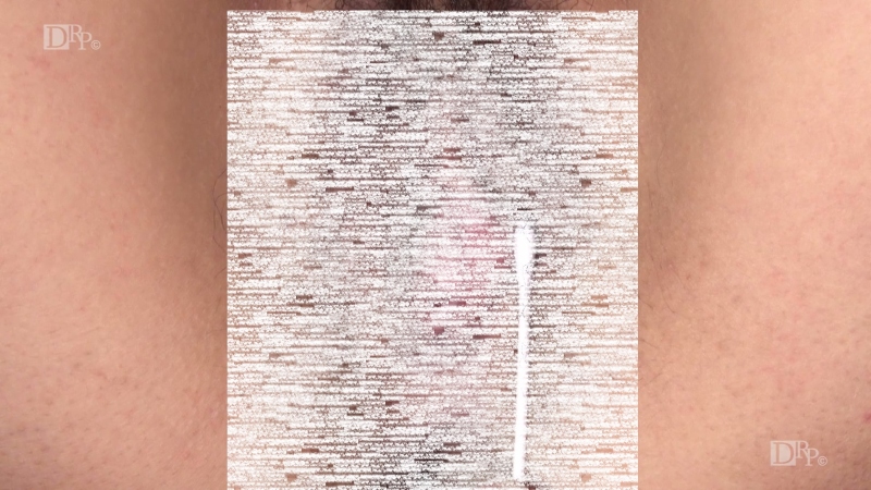 06031711376
