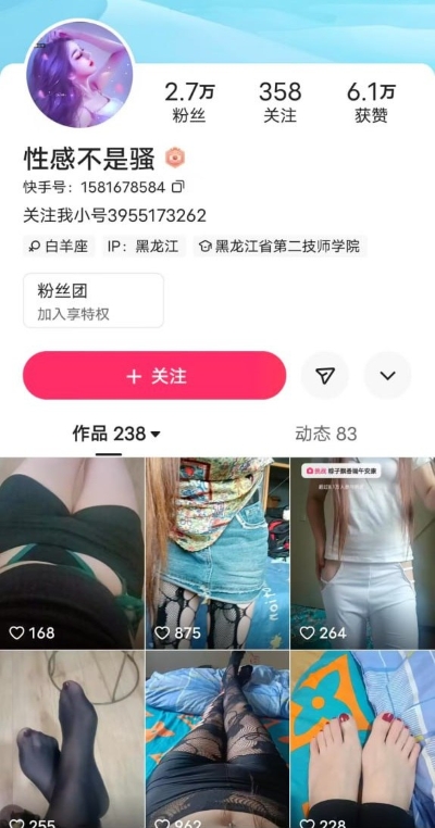 16084519188