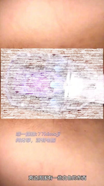 23103557698