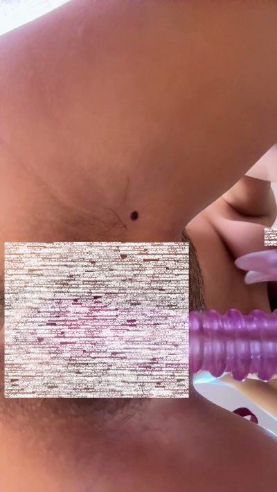 18191426433